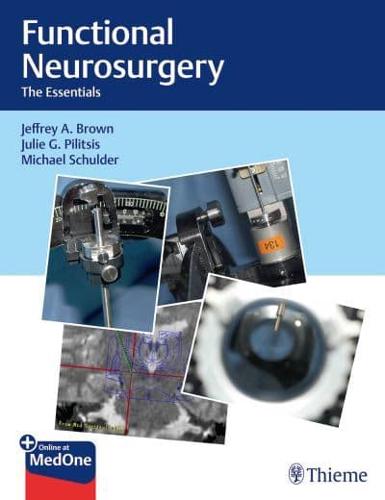 Functional Neurosurgery