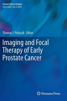 Imaging and Focal Therapy of Early Prostate Cancer