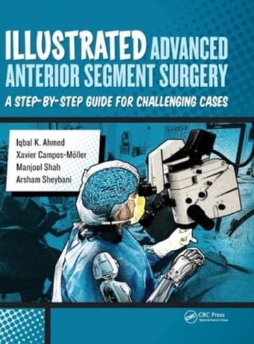 Illustrated Advanced Anterior Segment Surgery