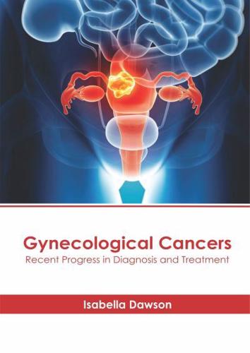 Gynecological Cancers: Recent Progress in Diagnosis and Treatment