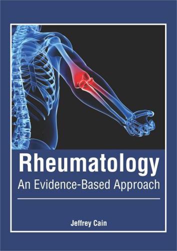 Rheumatology: An Evidence-Based Approach