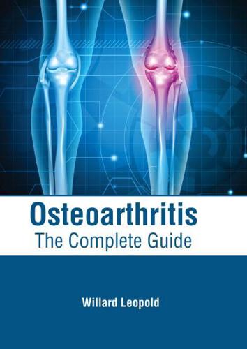 Osteoarthritis: The Complete Guide