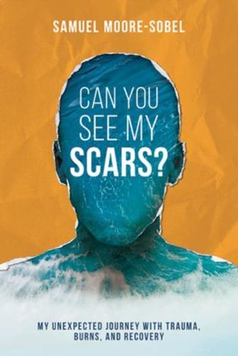 Can You See My Scars?