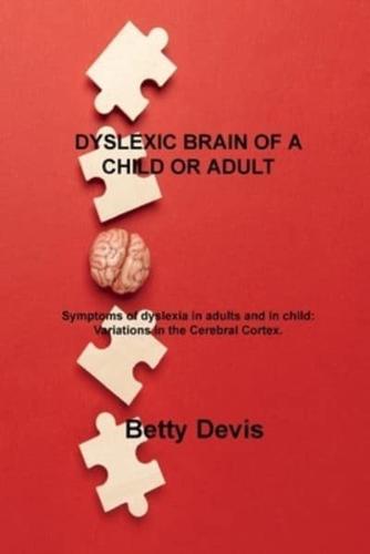 DYSLEXIC BRAIN OF A CHILD OR ADULT: Symptoms of dyslexia in adults and in child: Variations in the Cerebral Cortex.