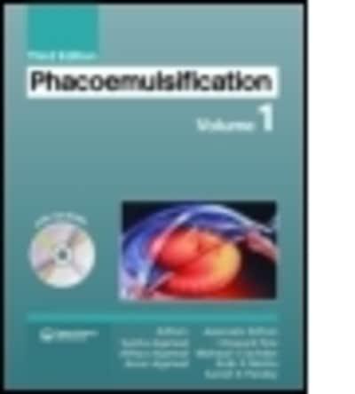 Phacoemulsification