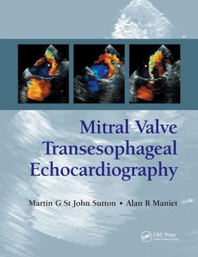 Mitral Valve Transesophageal Echocardiography