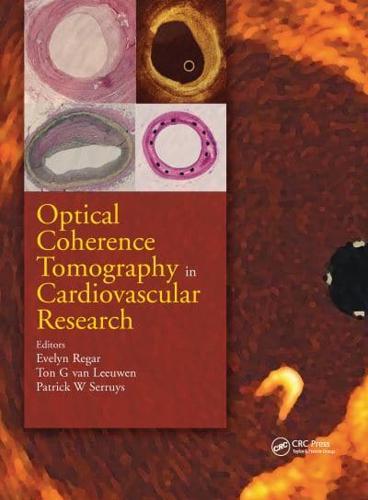 Optical Coherence Tomography in Cardiovascular Research