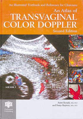 An Atlas of Transvaginal Color Doppler