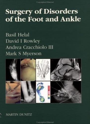 Surgery of Disorders of the Foot and Ankle