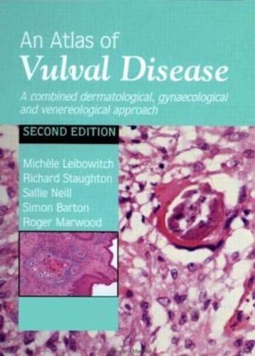 An Atlas of Vulval Disease