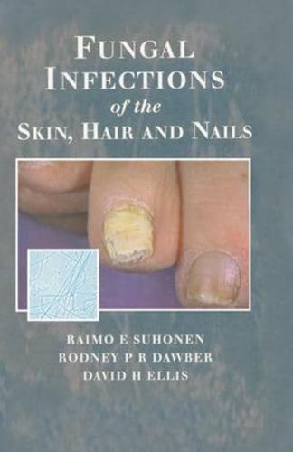 Fungal Infections of the Skin, Hair and Nails