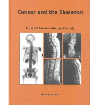 Cancer and the Skeleton