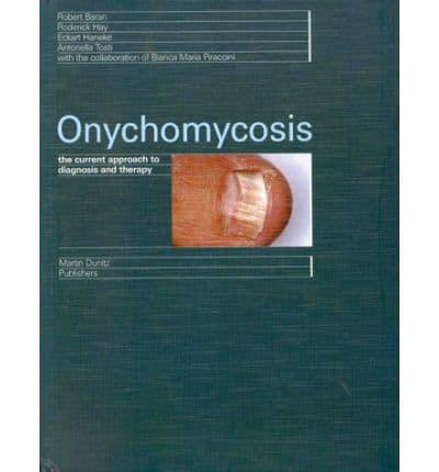 Onychomycosis