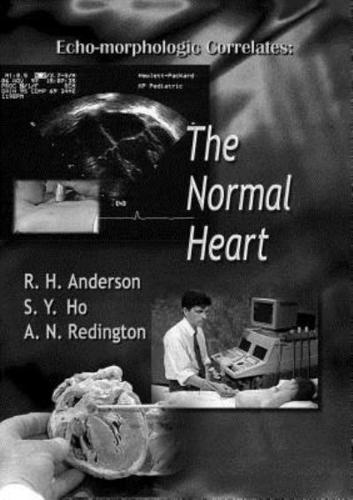 Echo-Morphologic Correlates: The Normal Heart (With Video)