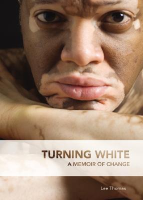 Turning White