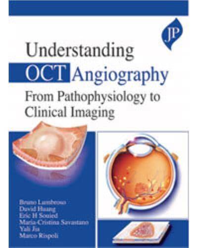 Understanding OCT Angiography