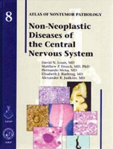 Non-Neoplastic Diseases of the Central Nervous System