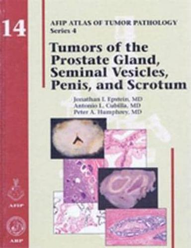 Tumors of the Prostate Gland, Seminal Vesicles, Penis and Scrotum