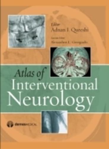 Atlas of Interventional Neurology