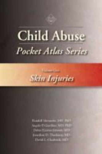 Child Abuse Pocket Atlas Series. Volume 1 Skin Injuries