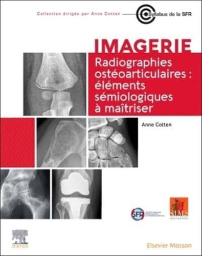 Radiographies Ostéoarticulaires : Éléments Sémiologiques À Maitriser