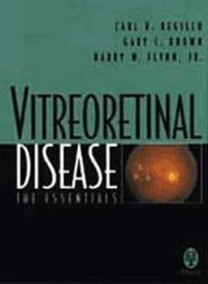 Vitreoretinal Disease: The Essentials