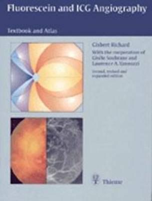 Fluorescein and ICG Angiography: Textbook and Atlas