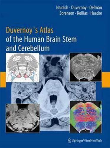 Duvernoy's Atlas of the Human Brain Stem and Cerebellum