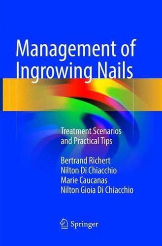 Management of Ingrowing Nails