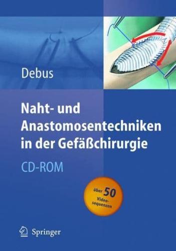 Naht- Und Anastomosentechniken in Der Gefächirurgie