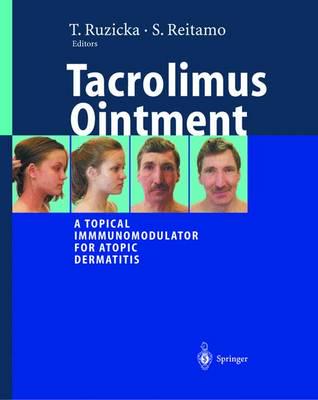 Tacrolimus Ointment