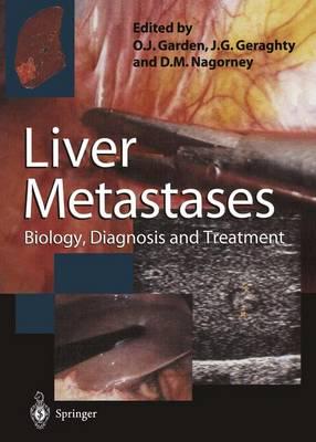 Liver Metastases