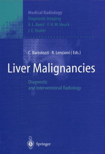 Liver Malignancies Diagnostic Imaging