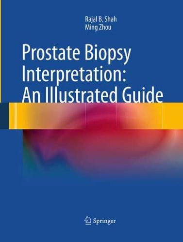 Prostate Biopsy Interpretation: An Illustrated Guide