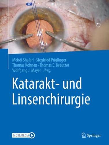 Katarakt- Und Linsenchirurgie