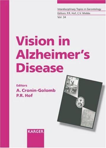 Vision in Alzheimer's Disease