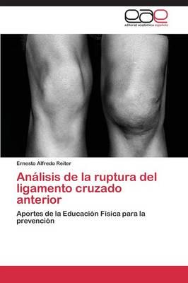 Analisis de La Ruptura del Ligamento Cruzado Anterior