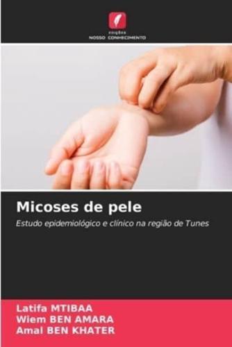 Micoses De Pele