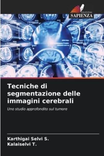 Tecniche Di Segmentazione Delle Immagini Cerebrali