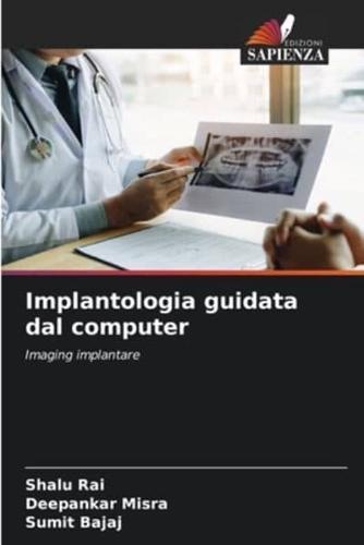 Implantologia Guidata Dal Computer