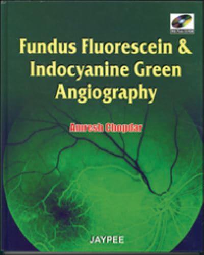 Fundus Fluorescien and Indocyanine Green Angiography