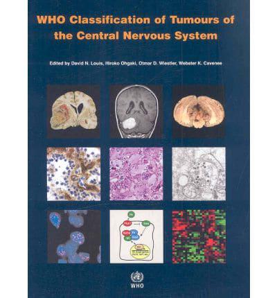 WHO Classification of Tumours of the Central Nervous System