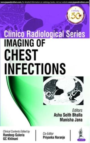 Imaging of Chest Infections