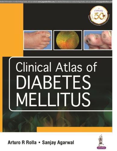 Clinical Atlas of Diabetes Mellitus