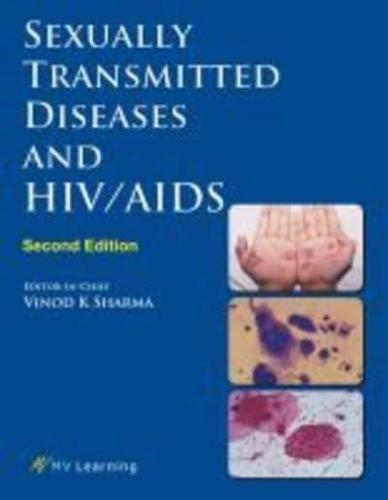 Sexually Transmitted Diseases and HIV/AIDS