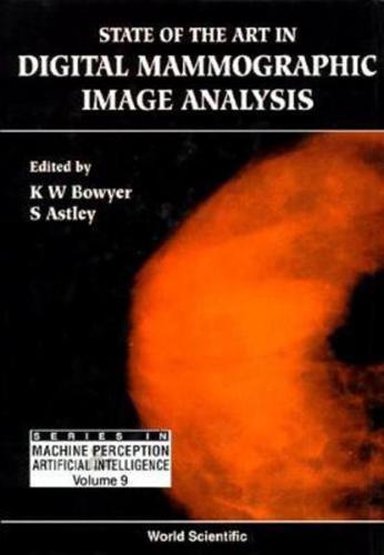State Of The Art In Digital Mammographic Image Analysis