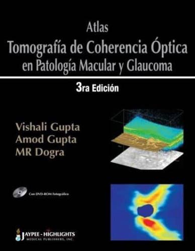 Atlas - Tomografía De Coherencia Óptica En Patología Macular Y Glaucoma
