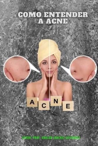 Como Entender a Acne