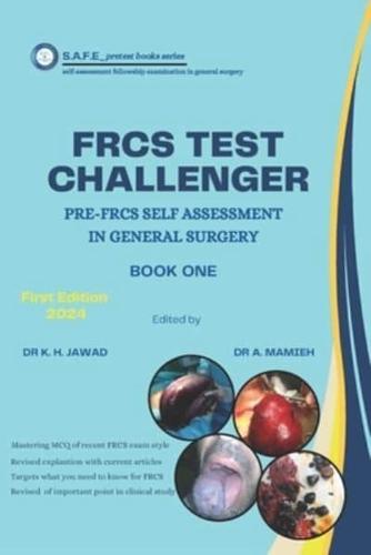 Frcs Test Challenger