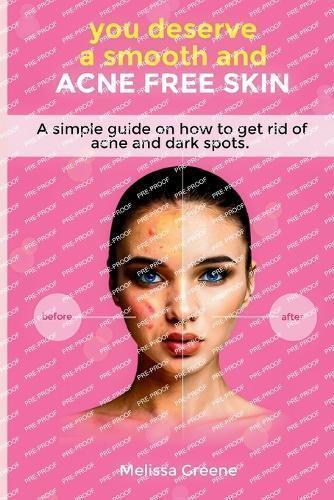 You Deserve a Smooth and Acne Free Skin